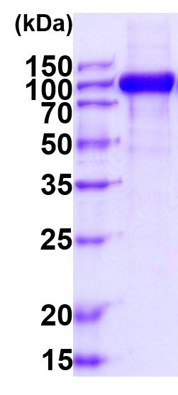 15% SDS-PAGE (3 μg)